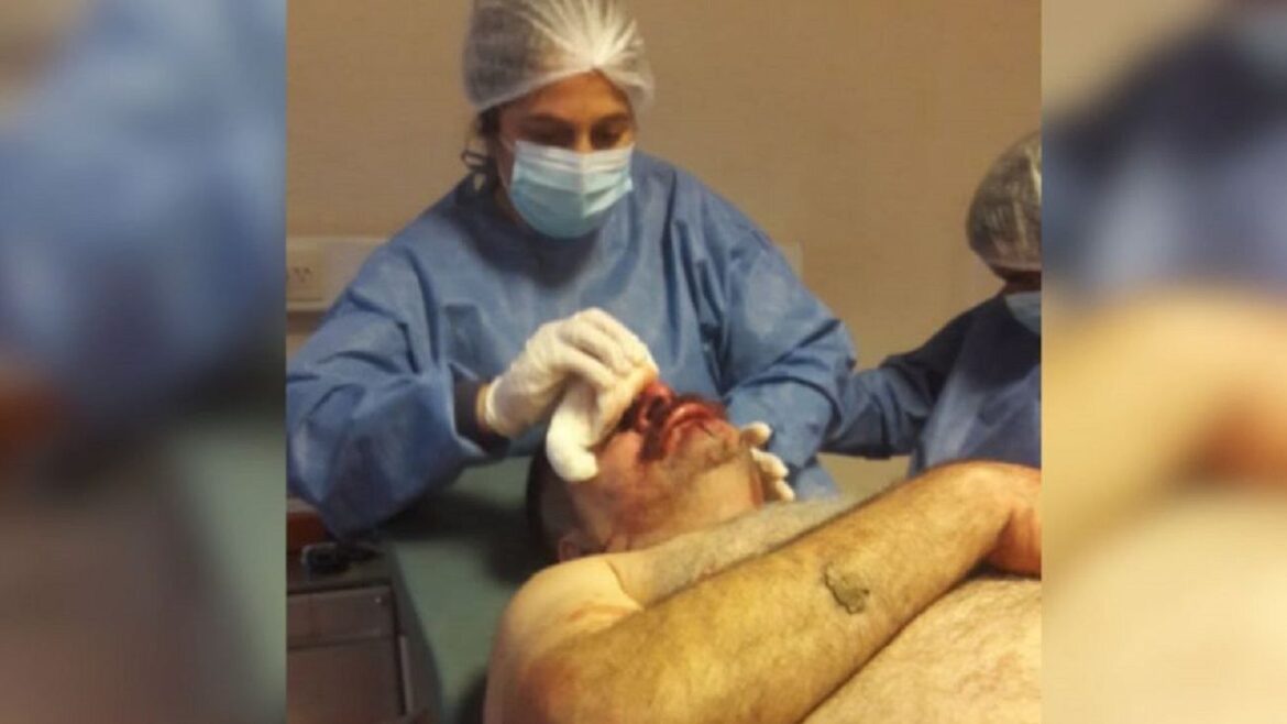 Brutal agresión a un periodista en Chaco por denunciar que funcionarios cobran el IFE
