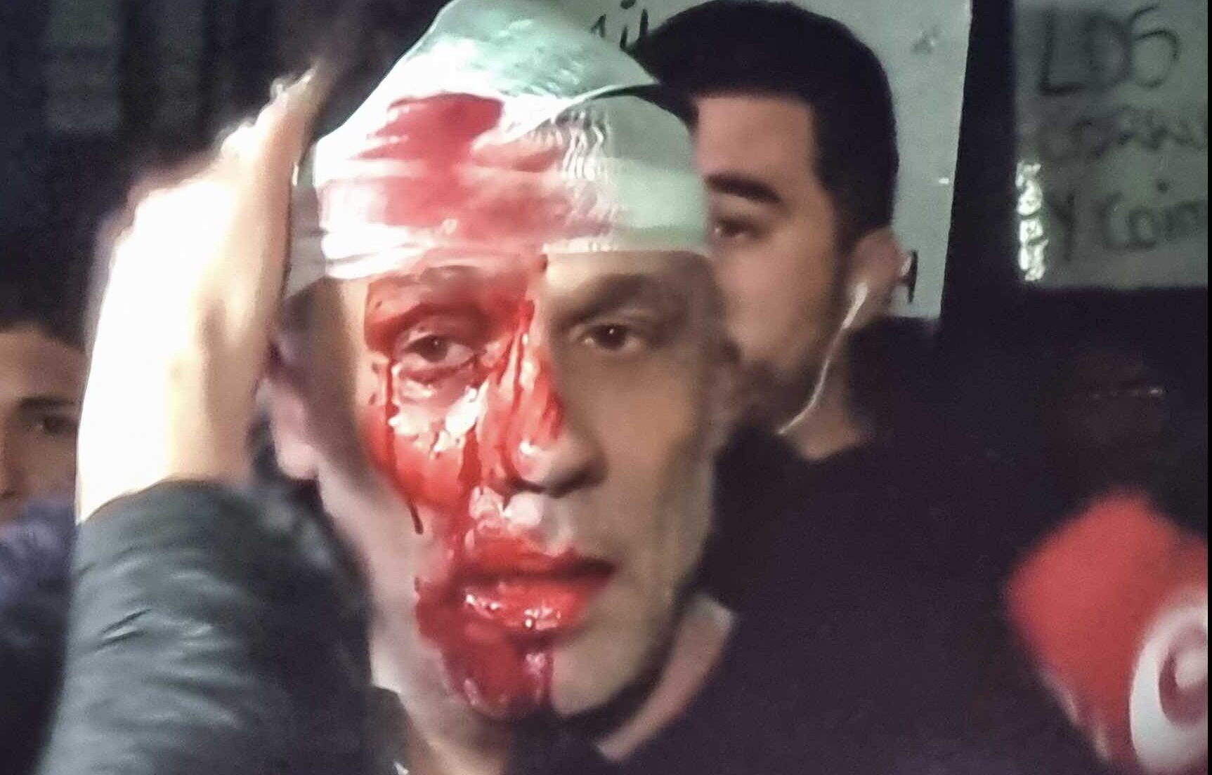 Agredieron a un cronista en el acto de Milei